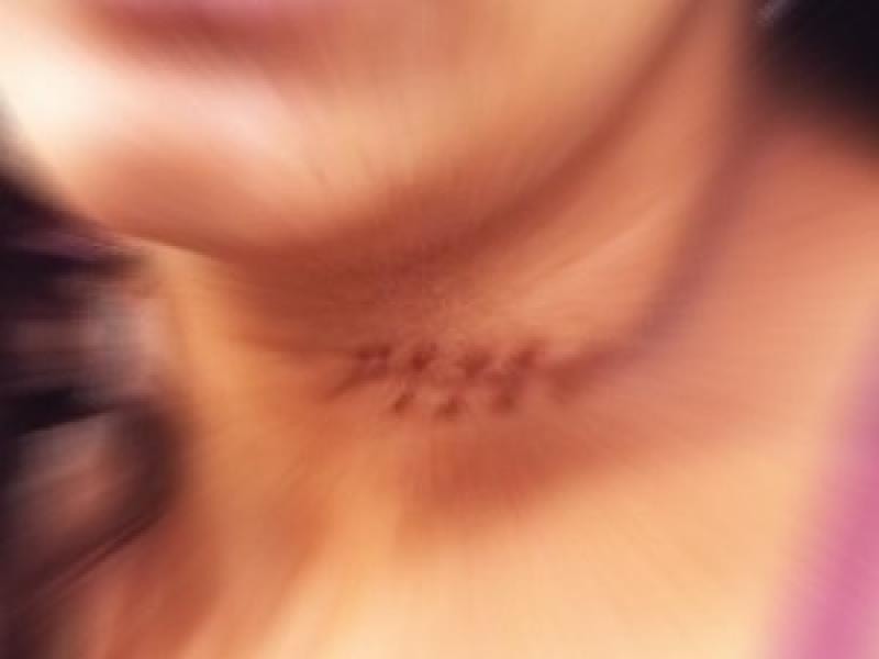 Covarde invade casa da ex e a esfaqueia no pescoço em Joaquim Távora