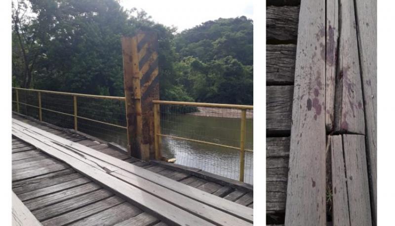 Menino com braço para fora de ônibus tem membro amputado após bater contra placa