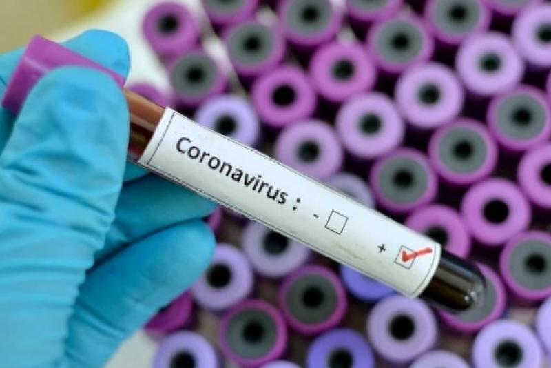 Região de Ourinhos fica em alerta com caso suspeito de coronavirus em Bauru