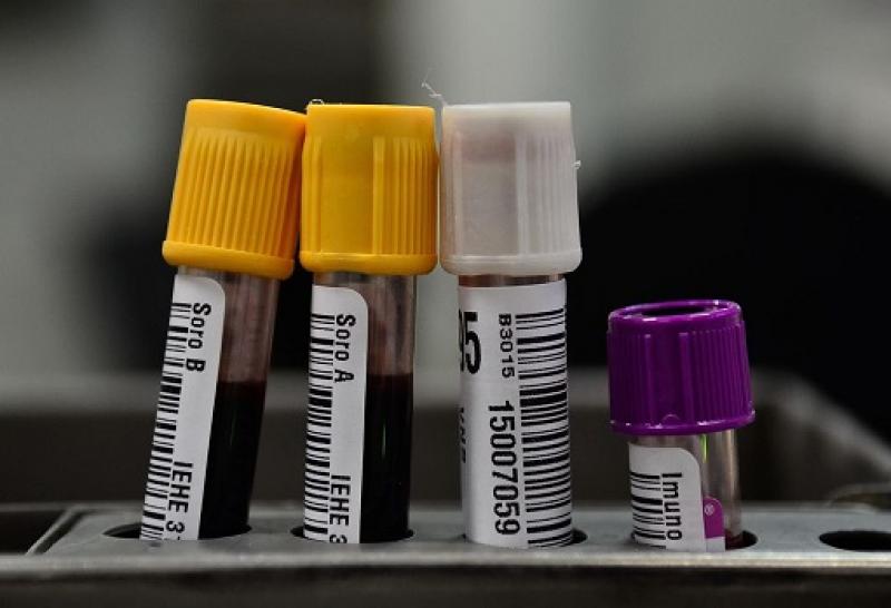 Hemorio inicia testes com plasma sanguíneo no tratamento de covid-19