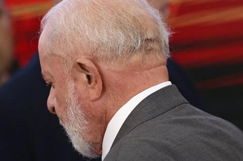 Médico de Lula descarta sequela e diz que função cerebral está intacta