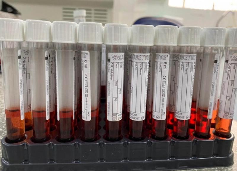 Paraná está perto dos 200 mil casos do novo coronavírus, mostra boletim atualizado