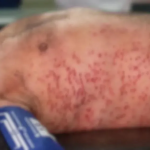 Ataque de abelhas deixa três feridos e termina com morte de estrangeiro em Wenceslau Braz