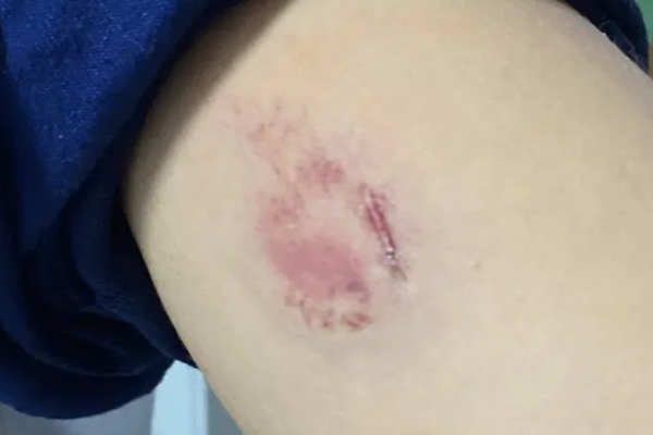 MULHER INVADE ESCOLA E AGRIDE ADOLESCENTE DE 13 ANOS DURANTE HORÁRIO DE AULA EM RIBEIRÃO DO PINHAL