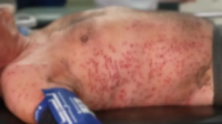 Ataque de abelhas deixa três feridos e termina com morte de estrangeiro em Wenceslau Braz