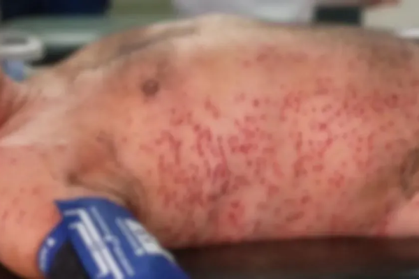 Ataque de abelhas deixa três feridos e termina com morte de estrangeiro em Wenceslau Braz