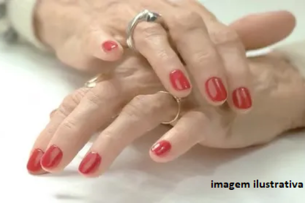 Homem é preso após atear fogo na companheira por causa de unhas pintadas de vermelho